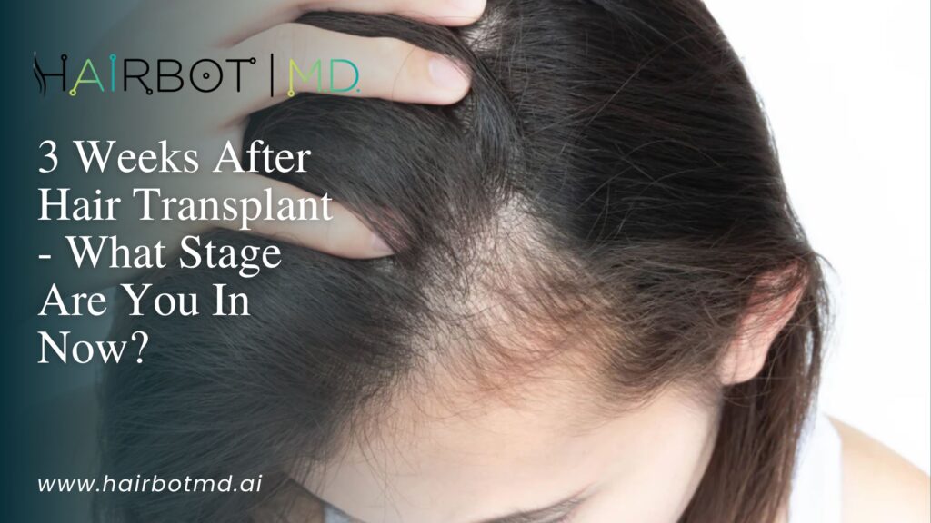 3 Weeks After Hair Transplant - What Stage Are You In Now? 