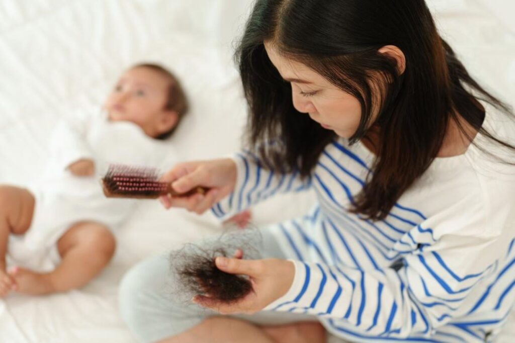 Postpartum Hair Loss